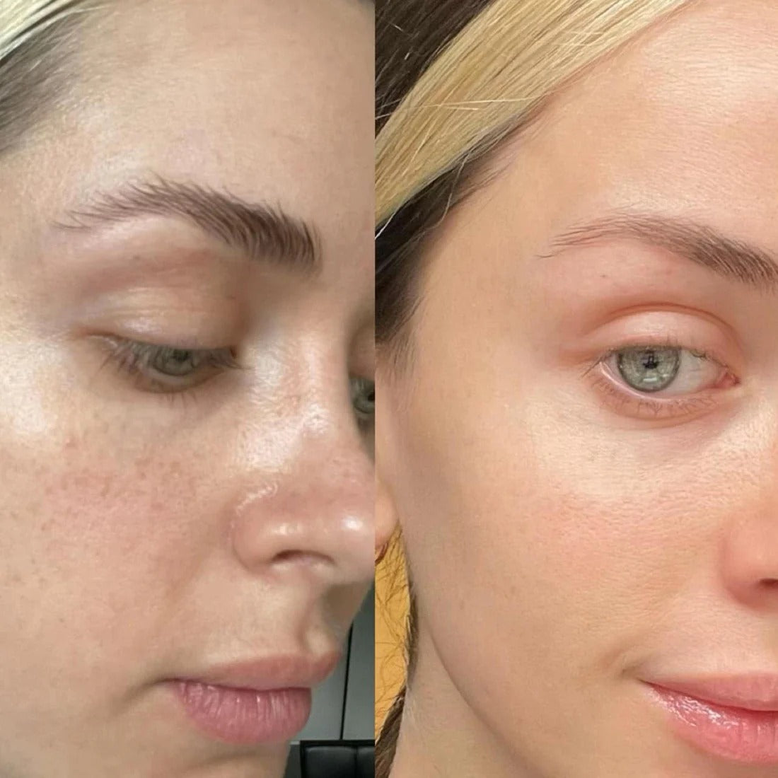 [NEW] MEDICUBE Glass Glow Skincare Kit (9 pcs)™